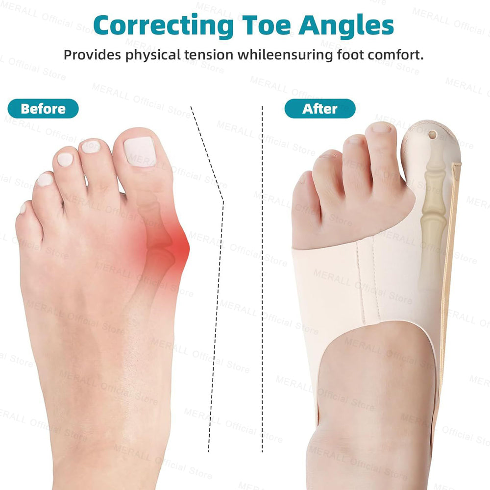 Premium Bunion Corrector Adjustable Orthopedic Socks - Toe Separator for Pain Relief, Hallux Valgus Foot Protector, 