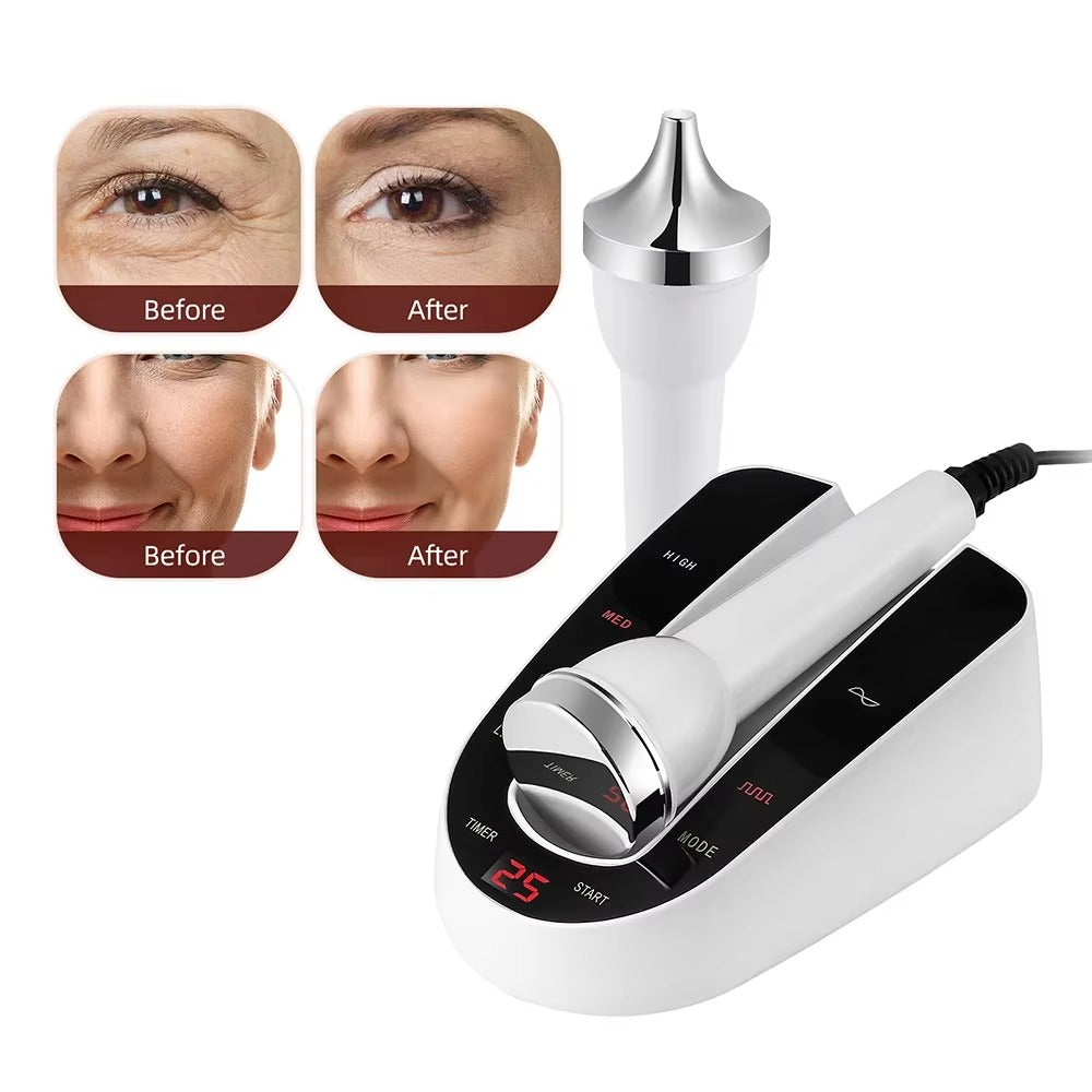 Premium Ultrasonic Beauty Machine – High Frequency Face & Eye Massager, 1MHz Facial Lifting & Ultrasonic Cleansing, Portable Skin Care Device - PhysioFitLab