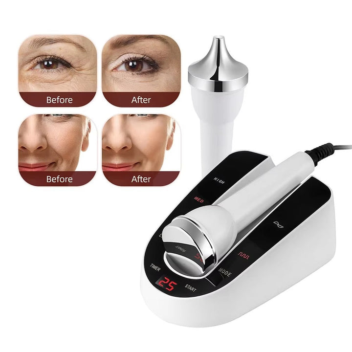 Premium Ultrasonic Beauty Machine – High Frequency Face & Eye Massager, 1MHz Facial Lifting & Ultrasonic Cleansing, Portable Skin Care Device - PhysioFitLab
