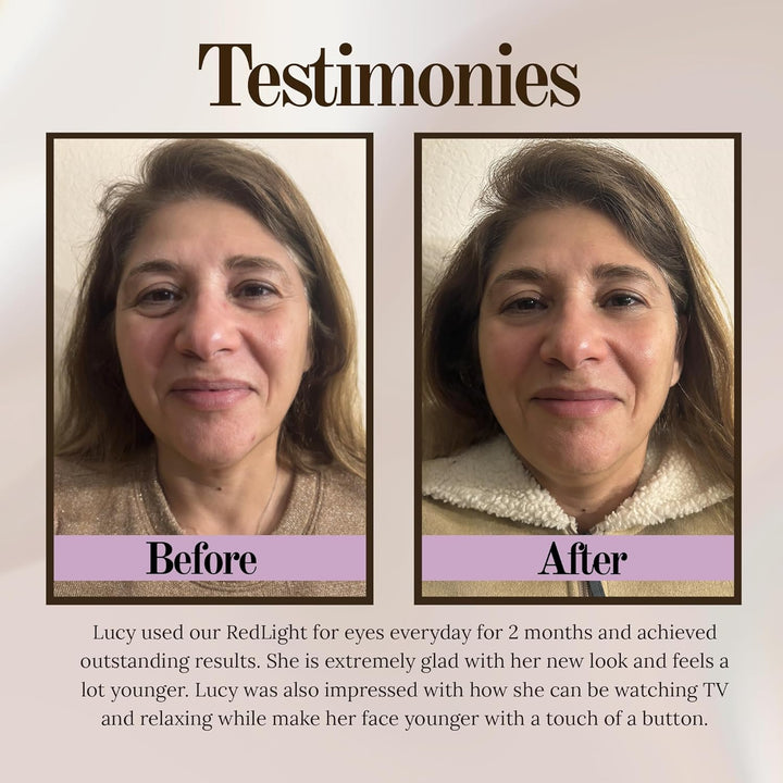 Premium LED Red Light Eye Therapy Massager with EMS and Gel Patches for Under Eye Wrinkle Treatment, 2 Modes, Rechargeable 