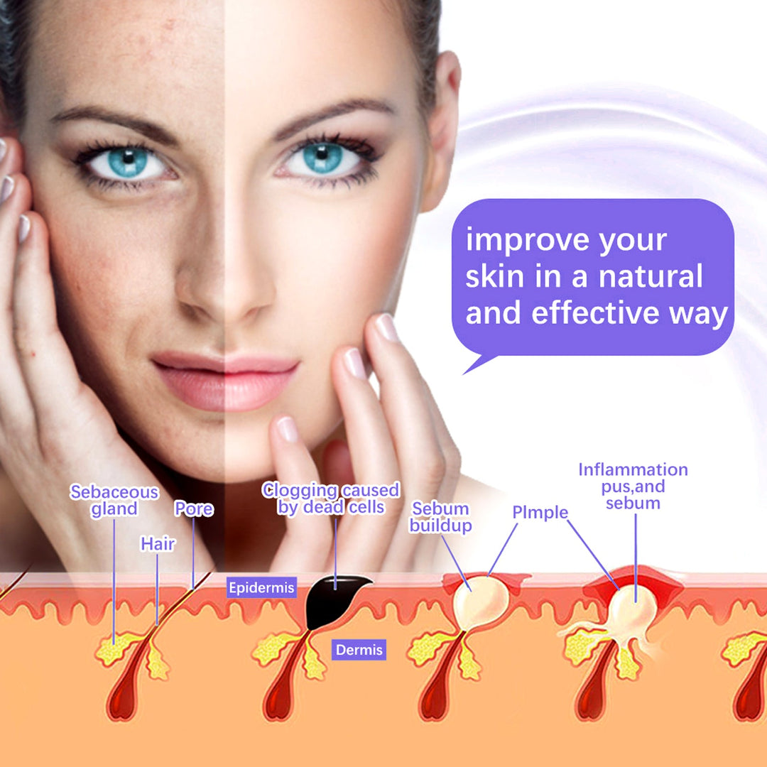 Premium High Frequency Facial Machine, Screen Display Electro Therapy Wand with Glass Tube, Anti-Acne & Wrinkle Removal, Skin