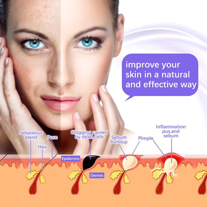 Premium High Frequency Facial Machine, Screen Display Electro Therapy Wand with Glass Tube, Anti-Acne & Wrinkle Removal, Skin