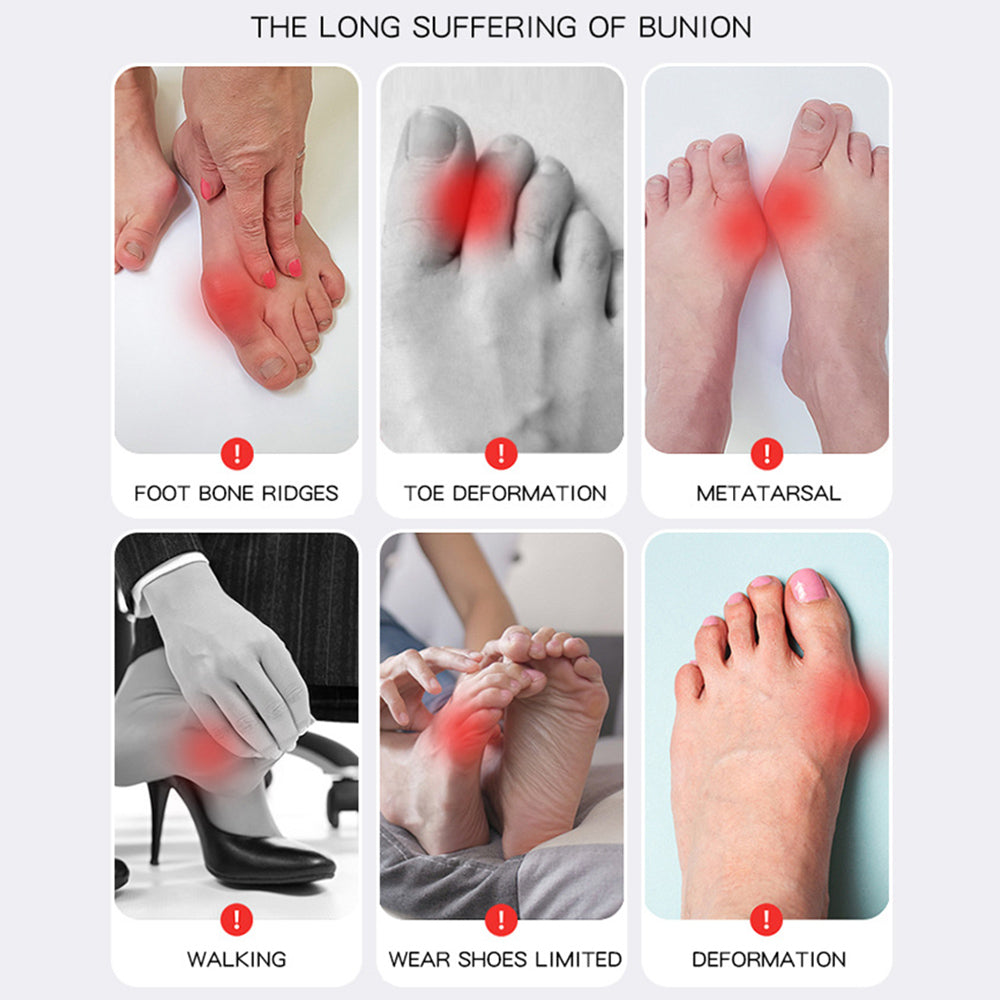 Premium Bunion Corrector Adjustable Orthopedic Socks - Toe Separator for Pain Relief, Hallux Valgus Foot Protector, 