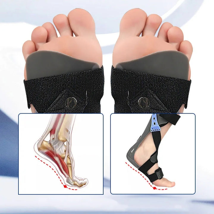 Premium AFO Drop Foot Brace Orthosis - Lightweight Ankle Support Stabilizer for Men and Women, Comfort Fit for Foot Drop, Arthritis, Sprains, and Rehabilitation, Multiple Sizes Available - PhysioFitLab