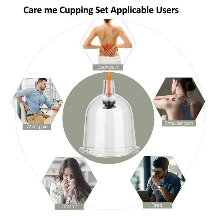 Premium Cupping Therapy Set – Professional Vacuum Suction Cups for Chinese Medicine Physiotherapy, Massage, and Muscle Relaxation, Durable Plastic Jars for Home and Professional Use - PhysioFitLab